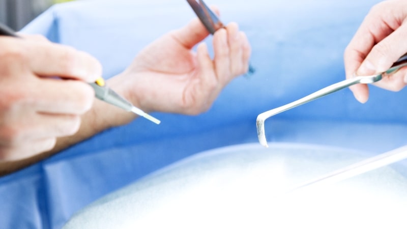 短いダウンタイムと高度な技術