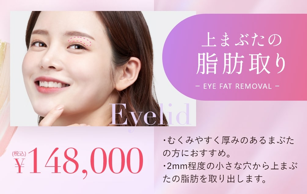 上瞼の脂肪取りsp