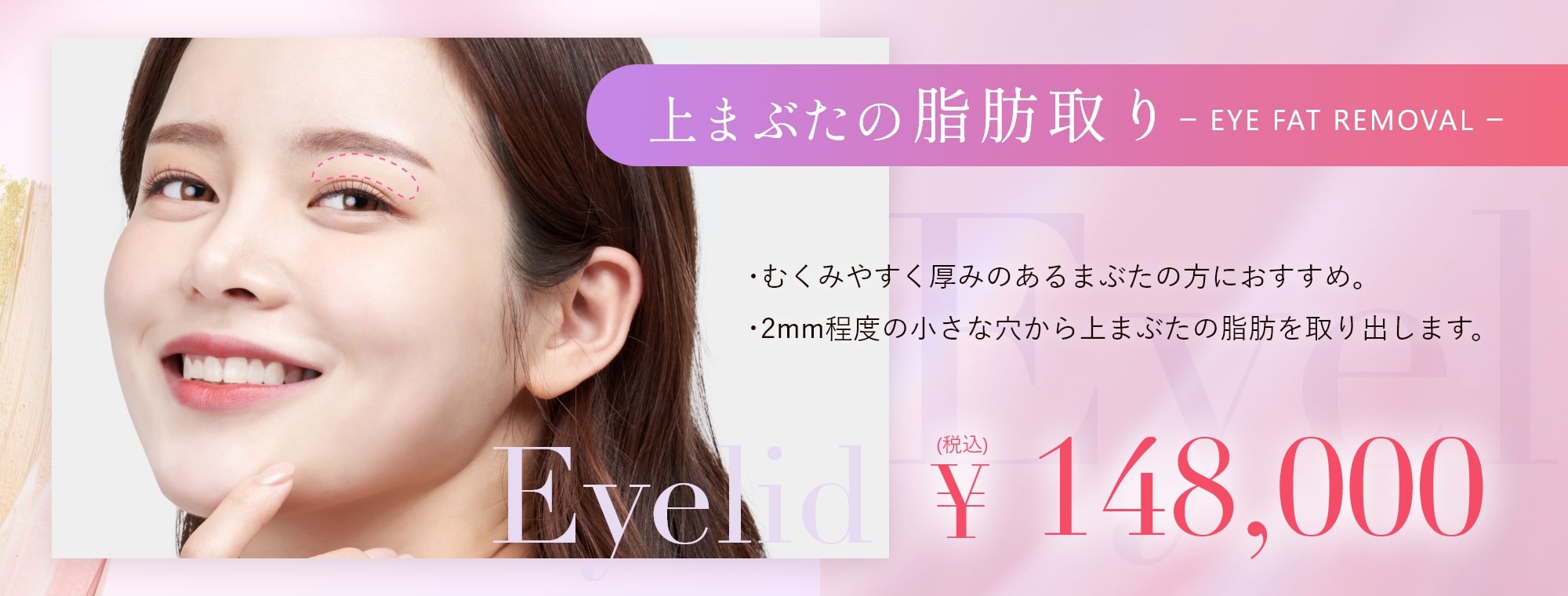 上瞼の脂肪取りpc