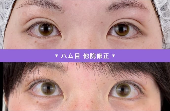 他院修正　ハム目