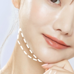 顎下脂肪吸引