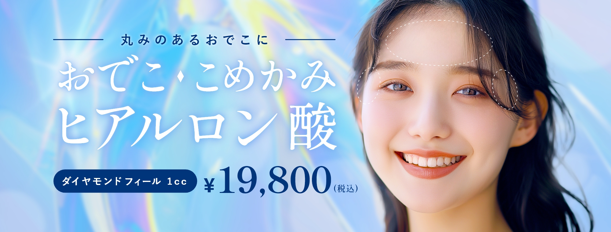 おでこ・こめかみヒアルロン酸